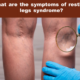 What are the symptoms of restless legs syndrome?