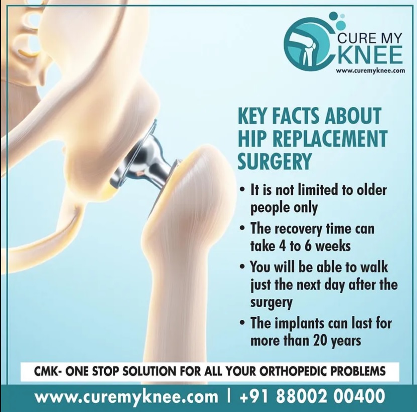 hip replacement surgery surgeon in delhi ncr 83121132