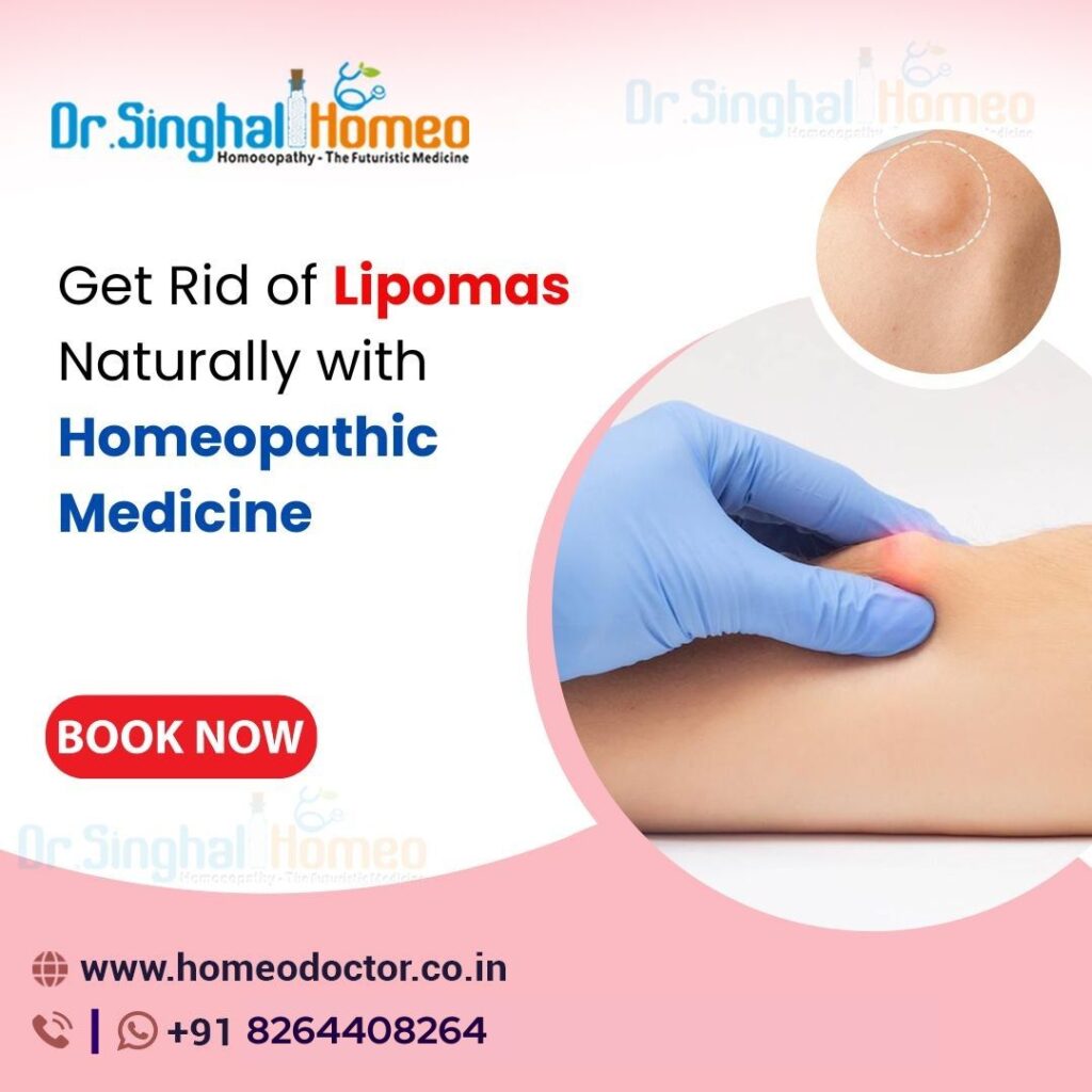 get rid of lipomas naturally with homeopathic medicine c017c171