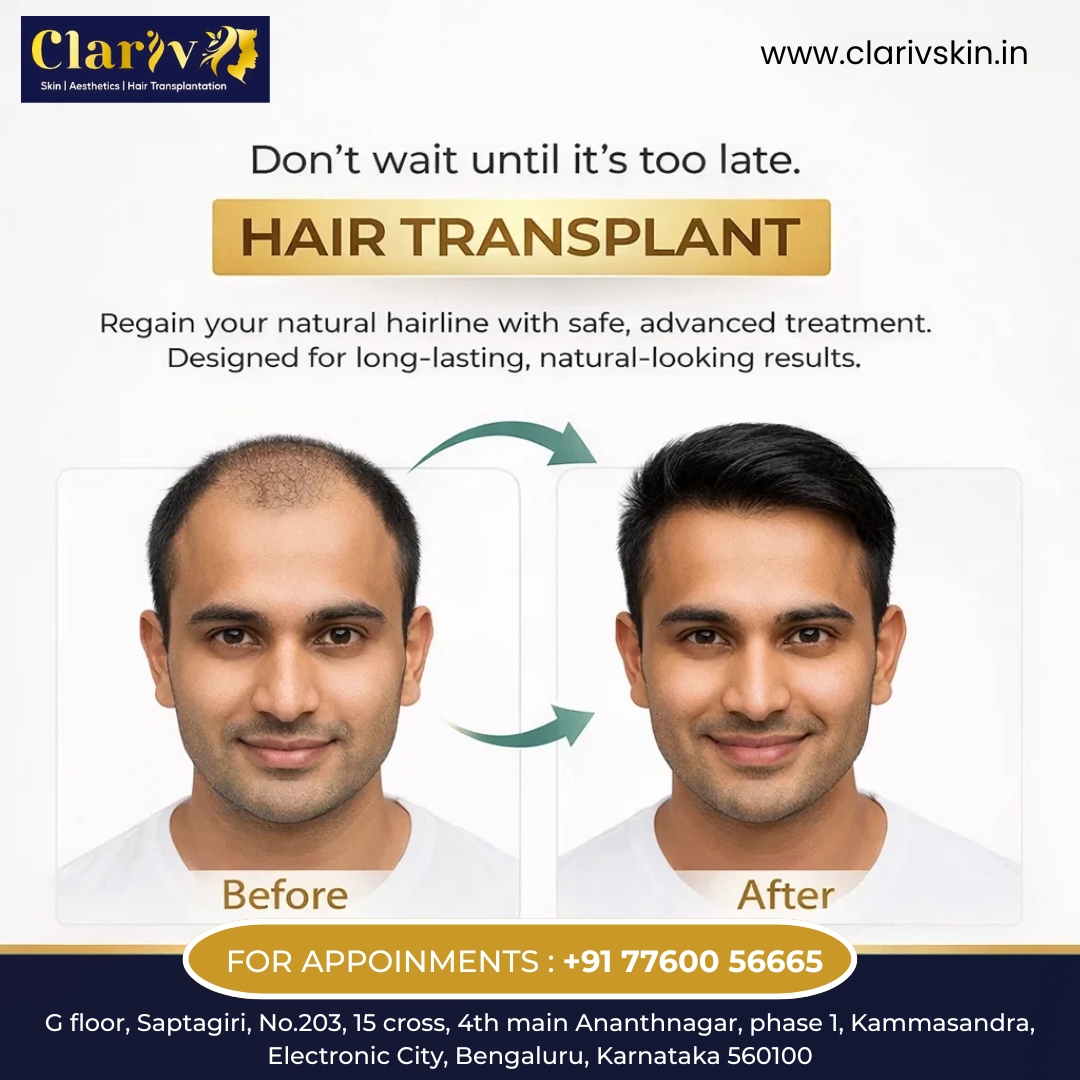 HSR Layout’s Trusted Destination for Hair Transplant Treatment | Clarivskin.in