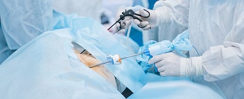 4.-General-Laparoscopic-Surgery