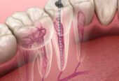 McClane Dentistry